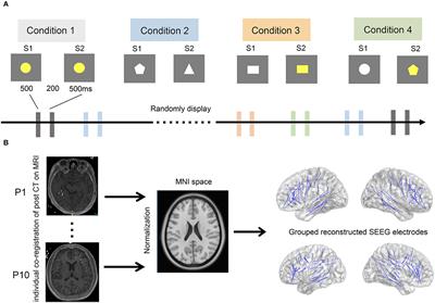 Distinct Patterns of Automatic and Controlled Incongruent Information Processing in the Human Brain